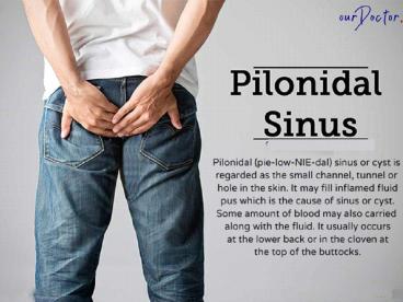 Pilonidal Sinus