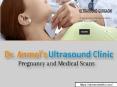 Top-Notch Service of Ultrasound in Gurgaon PowerPoint PPT Presentation