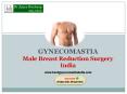 Best Gynecomastia Surgeon in India PowerPoint PPT Presentation
