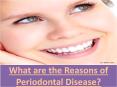 What are the Reasons of Periodontal Disease? PowerPoint PPT Presentation