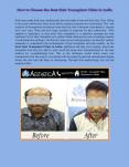How to Choose the Best Hair Transplant Clinic in India PowerPoint PPT Presentation