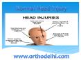 Normal head injury PowerPoint PPT Presentation