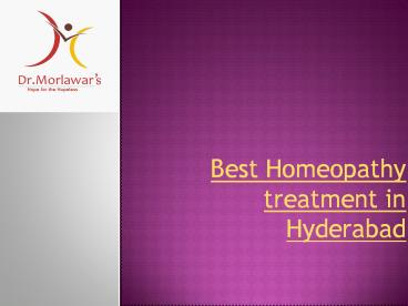 Best Homeopathy Clinics in Hyderabad, Bangalore, Chennai - India