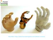 Best Quality upper Limb Orthotic