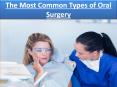 The Most Common Types of Oral Surgery PowerPoint PPT Presentation