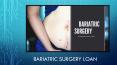 Benefits Of Choosing Bariatric Surgery Loan | TLC PowerPoint PPT Presentation
