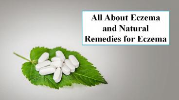 All About Eczema and Natural Remedies for Eczema