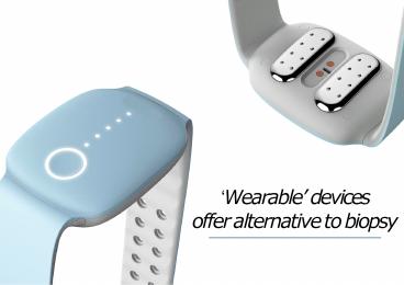 Wearable Devices Offer Alternative To Biopsy Techugo