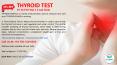 Thyroid Test (1) PowerPoint PPT Presentation