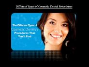 Best Cosmetic Dental Procedures