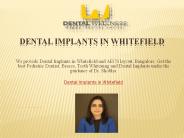 Dental Implants in Whitefield