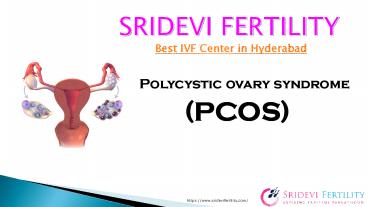 PCOS Treatment in Hyderabad | Fertility Centres in Hyderabad | Sridevi Fertility