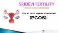 PCOS Treatment in Hyderabad | Fertility Centres in Hyderabad | Sridevi Fertility PowerPoint PPT Presentation
