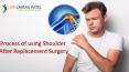 Using Shoulder After Replacement Surgery | Dr Chirag Patel PowerPoint PPT Presentation