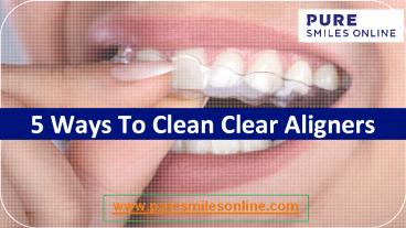 5 Ways To Clean Your Clear Aligners