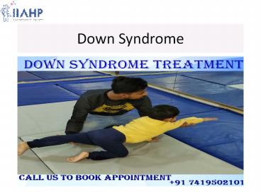 Down Syndrome Treatment (1)