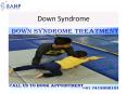 Down Syndrome Treatment (1) PowerPoint PPT Presentation