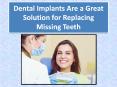 Dental Implants Are A Great Solution For Replacing Missing Teeth PowerPoint PPT Presentation
