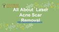 All About  Laser Acne Scar Removal PowerPoint PPT Presentation