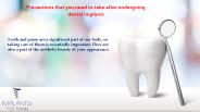 Dental implants los angeles