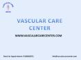 Varicose Veins Treatment In Hyderabad PowerPoint PPT Presentation