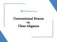SR DENTAL – Conventional Braces vs Clear Aligners PowerPoint PPT Presentation