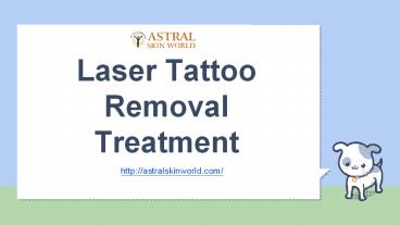 Laser Tattoo Removal Treatment