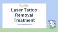 Laser Tattoo Removal Treatment PowerPoint PPT Presentation