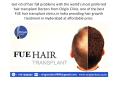 hair transplantation PowerPoint PPT Presentation