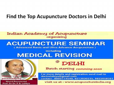 Top Acupuncture Doctors Delhi