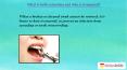 Tooth Extraction (1) PowerPoint PPT Presentation