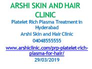 PRP treatment in hyderabad