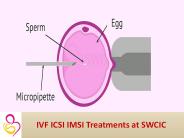IVF ICSI IMSI treatment