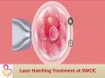 Laser Hatching Treatment PowerPoint PPT Presentation