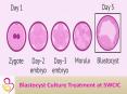 Blastocyst Culture Treatment PowerPoint PPT Presentation