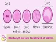 Blastocyst Culture Treatment