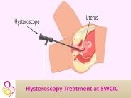 Hysteroscopy for Infertility