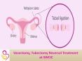 Vasectomy Tubectomy Reversal Treatment PowerPoint PPT Presentation