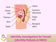 Infertility Investigations for Female infertility patients