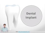 Dental Implants in Gurgaon- Dr. RajaGopal's Clinic.