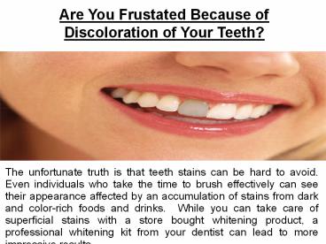 Are You Frustated Because of Discoloration of Your Teeth (1)