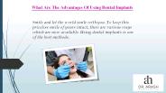 Dental implants Los Angeles
