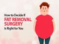 Fat Removal Surgery - Try Liposuction for Permanent Fat Loss PowerPoint PPT Presentation