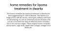 Home Remedies For Lipoma Treatment in Dwarka | Dr Ashish Bhanot | 9210000084 (1) PowerPoint PPT Presentation