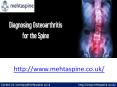 Diagnosing Osteoarthritis for the Spine PowerPoint PPT Presentation