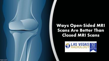 Opensided Mri Ways Open-Sided MRI Scans Are Better Than Closed MRI Scans presentation ...