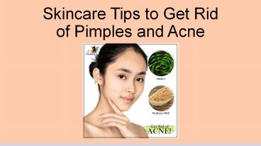 Skincare Tips to Get Rid of Pimples and Acne