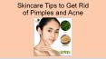 Skincare Tips to Get Rid of Pimples and Acne PowerPoint PPT Presentation