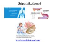 sripathikethumd-190524062122