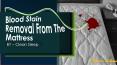 Blood Stain Removal From The Mattress PowerPoint PPT Presentation